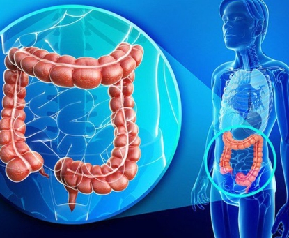  Có cần điều trị bổ trợ sau mổ ung thư trực tràng